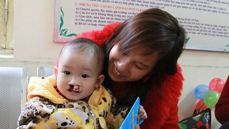 Child with cleft lip receiving care and support from healthcare worker